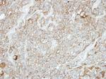 PCDH1 Antibody in Immunohistochemistry (Paraffin) (IHC (P))