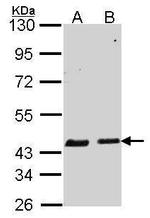 SERPINB6 Antibody in Western Blot (WB)