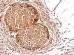 SLA Antibody in Immunohistochemistry (Paraffin) (IHC (P))