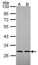 SLA Antibody in Western Blot (WB)