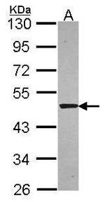 Syntrophin alpha-1 Antibody in Western Blot (WB)