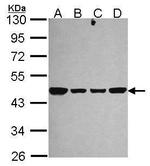 NDUFS2 Antibody in Western Blot (WB)