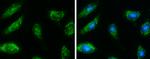 HSD17B4 Antibody in Immunocytochemistry (ICC/IF)