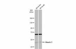 Ataxin 3 Antibody in Western Blot (WB)