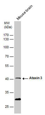 Ataxin 3 Antibody in Western Blot (WB)