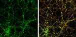 PPFIA1 Antibody in Immunocytochemistry (ICC/IF)