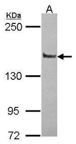 PPFIA1 Antibody in Western Blot (WB)