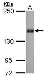 PPFIA1 Antibody in Western Blot (WB)