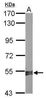 ALDH1A2 Antibody in Western Blot (WB)