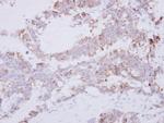 GRAP2 Antibody in Immunohistochemistry (Paraffin) (IHC (P))