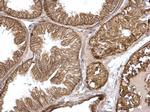 H-Ras Antibody in Immunohistochemistry (Paraffin) (IHC (P))