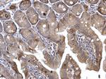 H-Ras Antibody in Immunohistochemistry (Paraffin) (IHC (P))