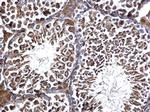 EDC3 Antibody in Immunohistochemistry (Paraffin) (IHC (P))