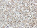 EDC3 Antibody in Immunohistochemistry (Paraffin) (IHC (P))