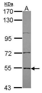 EDC3 Antibody in Western Blot (WB)