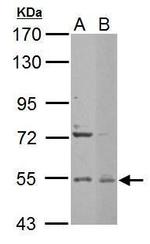 EDC3 Antibody in Western Blot (WB)