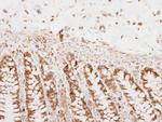 PNPase Antibody in Immunohistochemistry (Paraffin) (IHC (P))