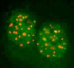 FANCD2 Antibody in Immunocytochemistry (ICC/IF)