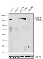 53BP1 Antibody in Western Blot (WB)