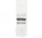 DCBLD2 Antibody in Western Blot (WB)