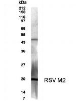 RSV M2 Antibody in Western Blot (WB)