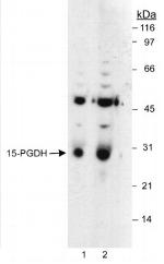 15-PGDH Antibody in Western Blot (WB)