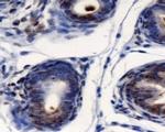 AGR2 Antibody in Immunohistochemistry (Paraffin) (IHC (P))