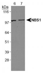 NBS1 Antibody in Western Blot (WB)