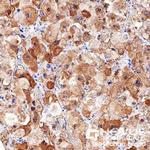 LDLR Antibody in Immunohistochemistry (Paraffin) (IHC (P))