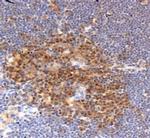 Profilin 1 Antibody in Immunohistochemistry (Paraffin) (IHC (P))