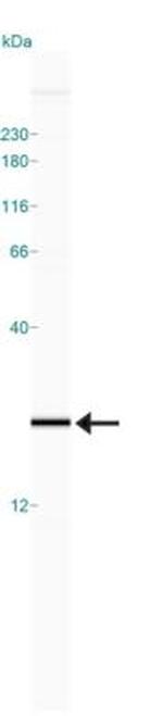 Profilin 1 Antibody in Western Blot (WB)