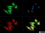 FER Antibody in Immunocytochemistry (ICC/IF)