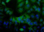 Folliculin Antibody in Immunocytochemistry (ICC/IF)