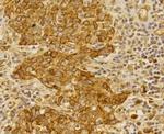 Folliculin Antibody in Immunohistochemistry (Paraffin) (IHC (P))