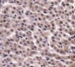 PKM2 Antibody in Immunohistochemistry (Paraffin) (IHC (P))