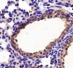 LDHA Antibody in Immunohistochemistry (Paraffin) (IHC (P))