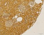 CCR2 Antibody in Immunohistochemistry (Paraffin) (IHC (P))