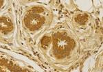 CCR2 Antibody in Immunohistochemistry (Paraffin) (IHC (P))