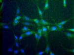 CCR2 Antibody in Immunocytochemistry (ICC/IF)