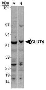 GLUT4 Antibody in Western Blot (WB)