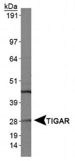 TIGAR Antibody in Western Blot (WB)