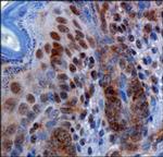 RBBP6 Antibody in Immunohistochemistry (Paraffin) (IHC (P))