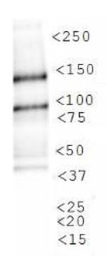 JMJD1A Antibody in Western Blot (WB)