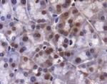 JMJD2A Antibody in Immunohistochemistry (Paraffin) (IHC (P))