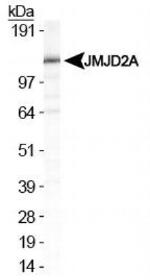 JMJD2A Antibody in Western Blot (WB)