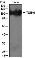 TGN46 Antibody in Western Blot (WB)