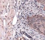 SDHB Antibody in Immunohistochemistry (Paraffin) (IHC (P))