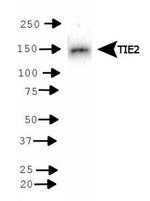 TEK Antibody in Western Blot (WB)