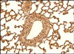 PTCH Antibody in Immunohistochemistry (Paraffin) (IHC (P))