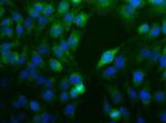 Nodal Antibody in Immunocytochemistry (ICC/IF)